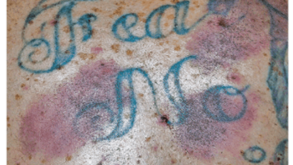 Guilty as Charged, But Still Not Legally Accountable?